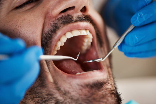 Best Broken or Chipped Tooth Repair in Llano, TX