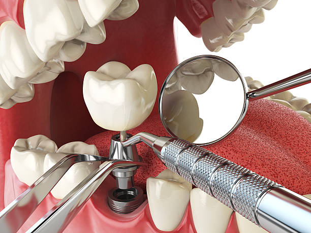 Best Emergency Treatment for Oral Infections in Llano, TX