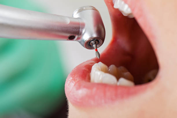 Best Emergency Pediatric Dental Care in Llano, TX